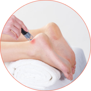 THEAL Therapy (Laserterapia podologica)